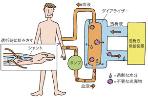 しくみ